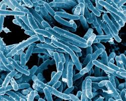 WBBSE Notes For Class 8 General Science And Environment Chapter 5 Analysis Of Natural Phenomena Mycobacterium Tuberculosis