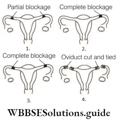 NEET Biology Population Stabilisation and Birth Control Uterus Is Fertilisation