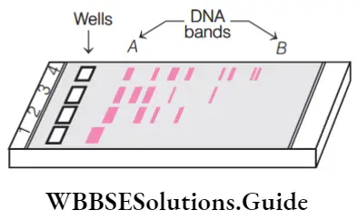 NEET Biology Tools of Recombinant DNA Technology MCQs DNA bands