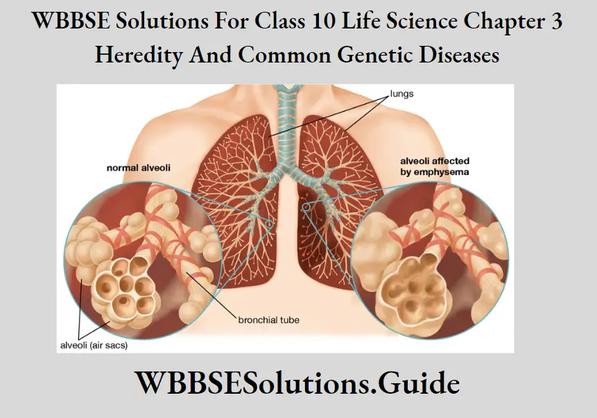 WBBSE Solutions Class 10 Life Science Chapter 3 Heredity And Common Genetic Diseases Lungs And Alveoli